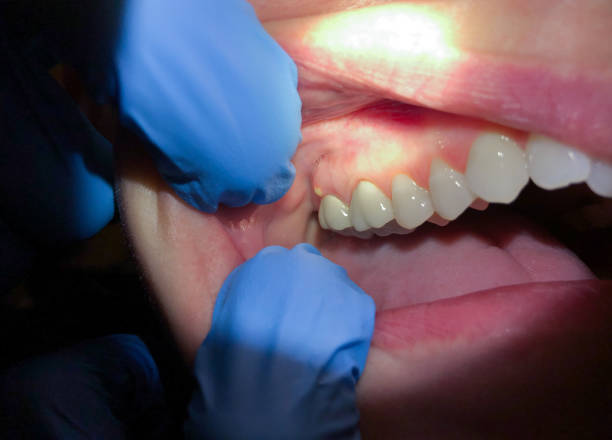 Best After-Hours Dental Care in Larned, KS