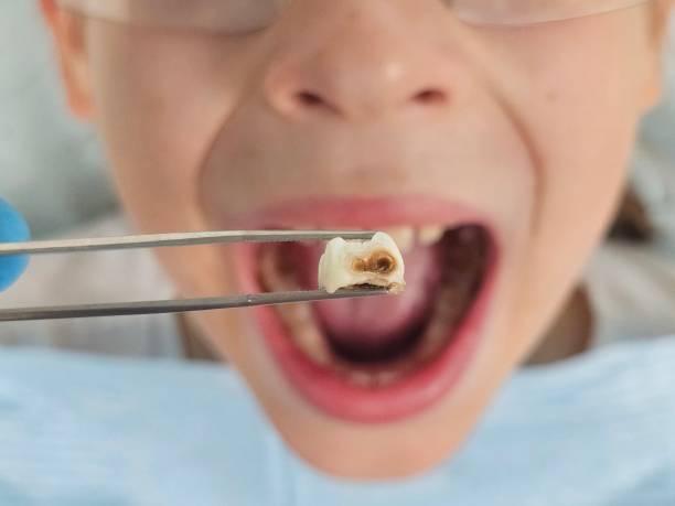 Best Walk-In Emergency Dental Services in Larned, KS
